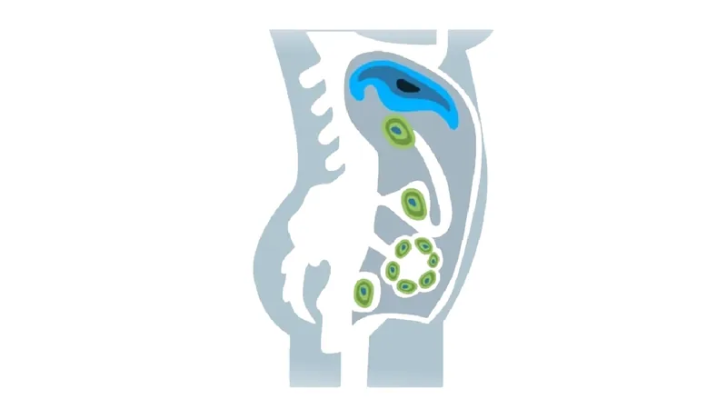 Supervivencia en carcinomatosis peritoneal: factores pronósticos y tratamientos